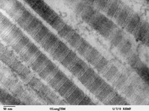 Sợi collagen type I